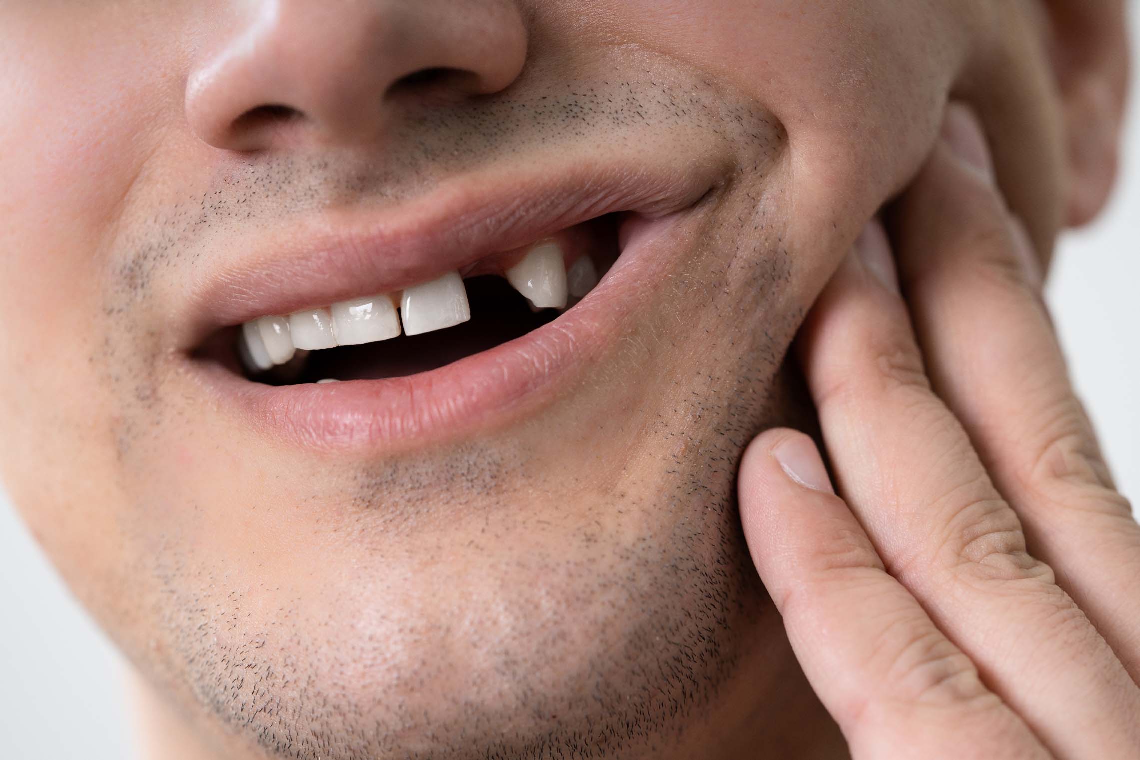 Closeup of man holding mouth with missing front tooth